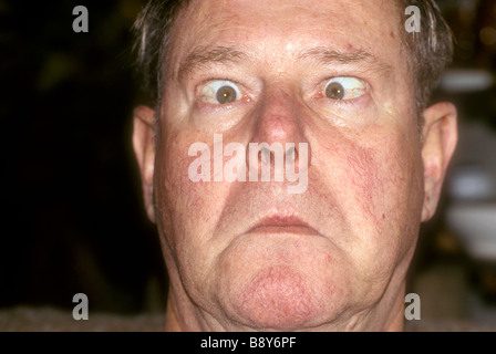 Cross eyed Mann Stockfoto