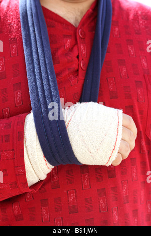 Bandagierten arm Stockfoto