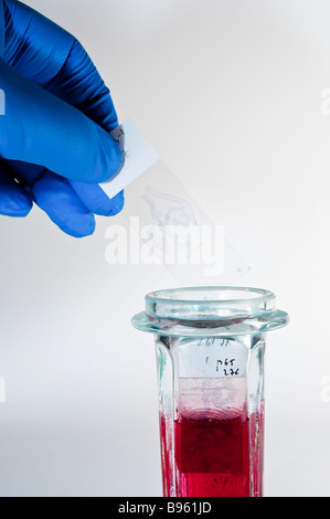 Forensische Pathologie Forschung Stockfoto