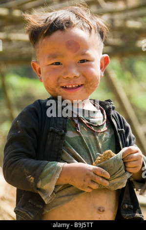 Hmong-junge mit lokalen heilende Druck auf der Stirn in Sapa Vietnam Stockfoto