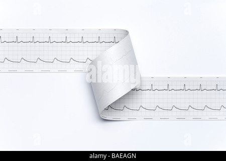 Regelmäßige Elektro Kardiogramm Stockfoto