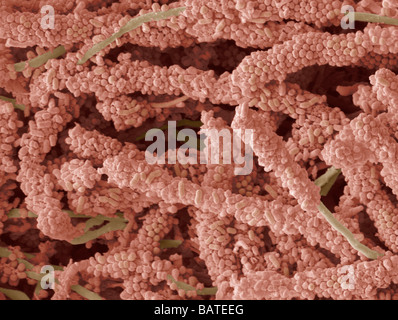 Plaque-bildende Bakterien, farbige Scanningelectron micrograph(SEM). Zahnbelag ist ein Biofilm von Bakterien, der auf den Zähnen bildet. Stockfoto