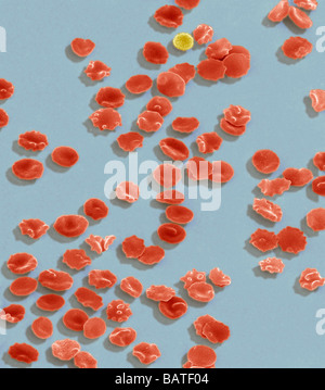 Blutkörperchen, farbige scanning Electron micrograph(SEM). Hier zu sehen sind leicht crenated (faltige) rote Blutkörperchen. Stockfoto