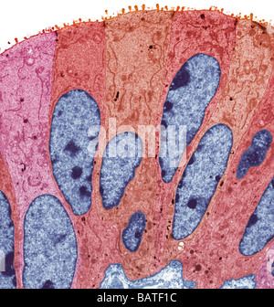 Eileiter, farbige Übertragung Electronmicrograph (TEM). Stockfoto