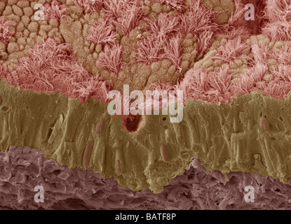 Schleimhaut der Luftröhre. Farbige Scanningelectron Schliffbild (SEM) von einem gebrochenen Mucousmembrane der Trachea (Luftröhre) Stockfoto