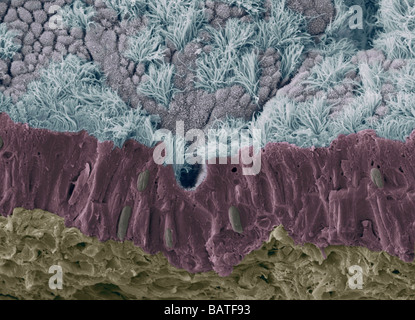 Schleimhaut der Luftröhre. Farbige Scanningelectron Schliffbild (SEM) von einem gebrochenen Mucousmembrane der Trachea (Luftröhre) Stockfoto