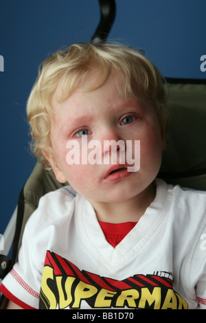 Nahaufnahme eines Kindes, hat gerade Weinen und hat immer noch Tränen in seine Augen und ein rotes Gesicht Stockfoto