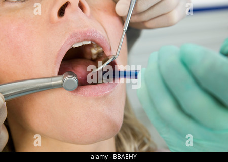 Nahaufnahme eines Zahnarztes Inspektion eines Weibes Mund Stockfoto