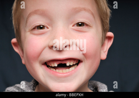 Porträt eines kleinen Jungen fehlen zwei Vorderzähne Stockfoto