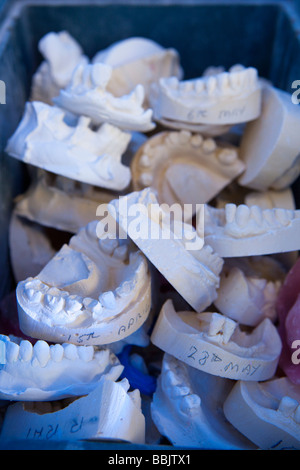 Gipsformen Zähne in blauen Kästchen Stockfoto