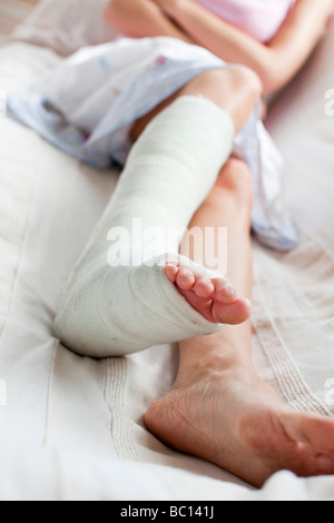 Frau mit gebrochenem Bein Stockfoto