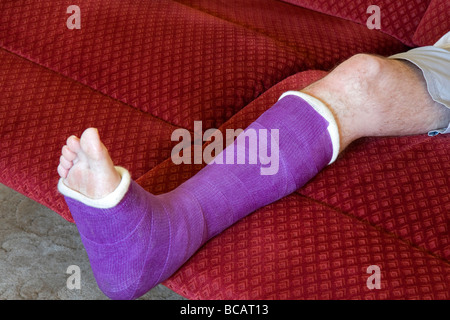 Man ruht gebrochenes Bein in Gips Stockfoto