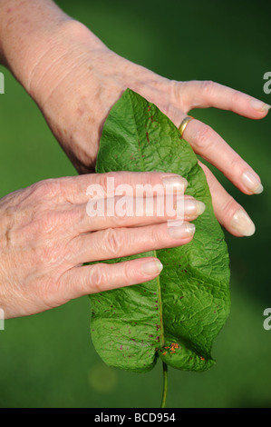 Behandlung von Bisses Brennnessel mit einem Dock-Blatt Stockfoto