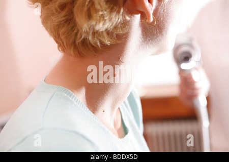 Arzt untersucht Patienten mit Muttermale Stockfoto