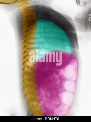 normales Röntgenbild ein 2 Monate altes Weibchen zeigen Brust und Bauch Stockfoto