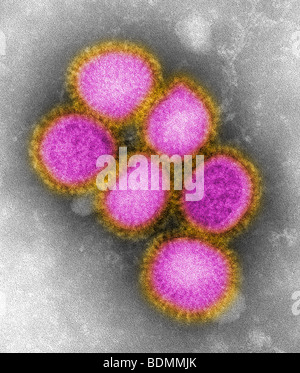 Bilder des neu entdeckten H1N1 Influenza-virus Stockfoto