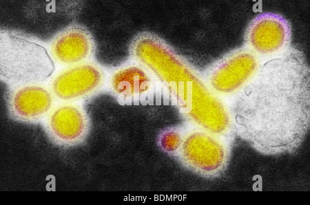 Negativ gefärbten Übertragung Elektronen Schliffbild (TEM) der nachgebildeten 1918 spanische Grippe A (H1N1) Virionen Stockfoto