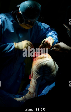 Ein Patient erfährt Kniegelenkersatz-Operationen in einem Krankenhaus West Midlands, nachdem er mit irreparablen Schäden diagnostiziert Stockfoto