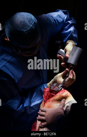 Ein Patient erfährt Kniegelenkersatz-Operationen in einem Krankenhaus West Midlands, nachdem er mit irreparablen Schäden diagnostiziert Stockfoto