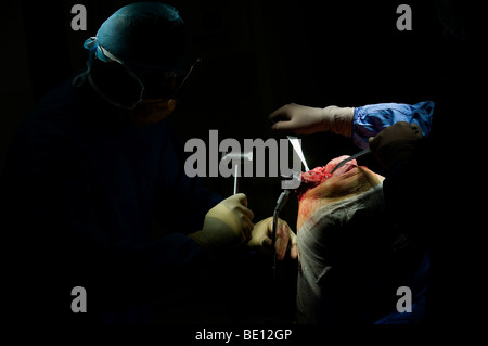 Ein Patient erfährt Kniegelenkersatz-Operationen in einem Krankenhaus West Midlands, nachdem er mit irreparablen Schäden diagnostiziert Stockfoto