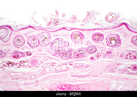 Hellfeld gebeizt Mikrophotographie Säugetier Haarfollikel in der Haut (Querschnitt von oben gesehen) Stockfoto