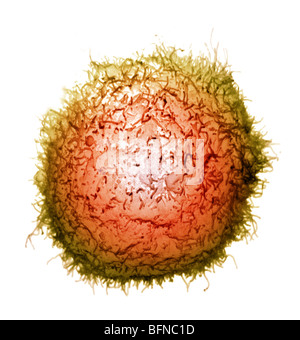 Rasterelektronenmikroskop (REM) Bild von einem menschlichen Makrophagen Stockfoto