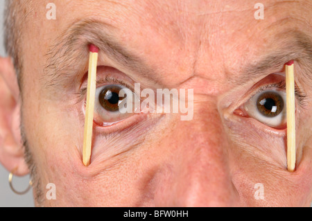 Nahaufnahme der hässlichen Mann, große Augen mit Match sticks öffnen Stockfoto