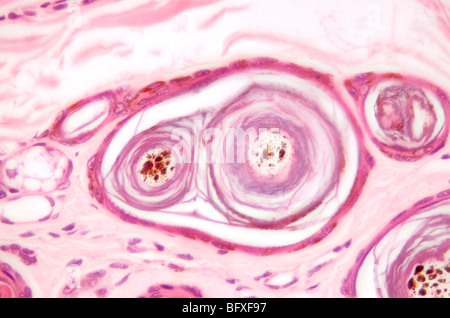 Säugetier-Haarfollikel ausführlich Aussenhaut, Hellfeld Mikrophotographie Stockfoto
