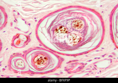 Säugetier-Haarfollikel ausführlich Aussenhaut, Hellfeld Mikrophotographie Stockfoto