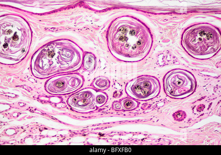 Säugetier-Haarfollikel ausführlich Aussenhaut, Hellfeld Mikrophotographie Stockfoto