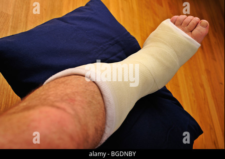 Detail eines Mannes ist Bein in Gips, erhöht auf einem Kissen kaputt. Stockfoto