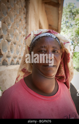 Eine Frau leidet Kropf wartet auf eine medizinische Ambulanz, Chekereni Village, Tansania, Ostafrika zu sehen. Stockfoto