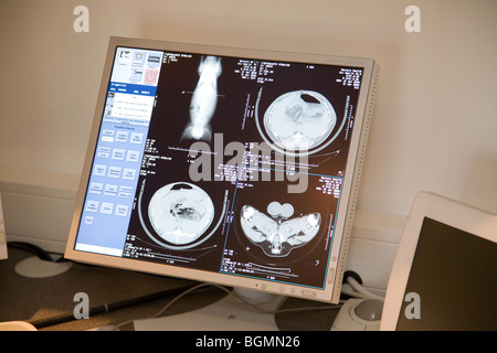 Ein Schaf in einem MRI-Scanner Stockfoto