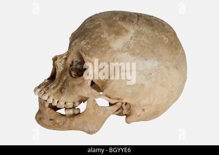 Menschlicher Schädel (Homo Sapiens) Stockfoto