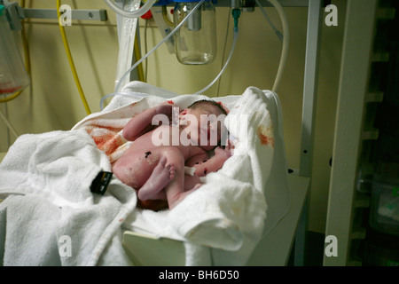 Neues Baby geboren jungen auf Skala im Krankenhaus Minuten nach der Geburt Stockfoto