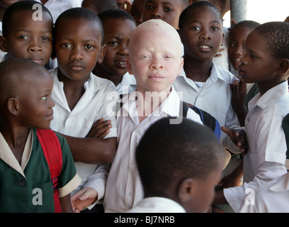 Junge Albino mit schwarzen Schülern an einer Schule in Mariannhill, Südafrika. In Afrika ist die Verfolgung von Menschen mit Albinismus nicht ungewöhnlich Stockfoto