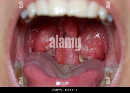 Mandeln Stockfoto, Bild: 52269907 - Alamy