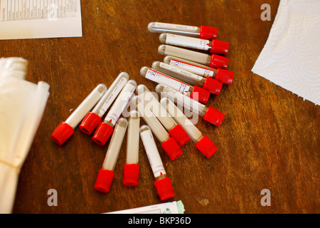 Blut-Ampullen für HIV-Tests Stockfoto