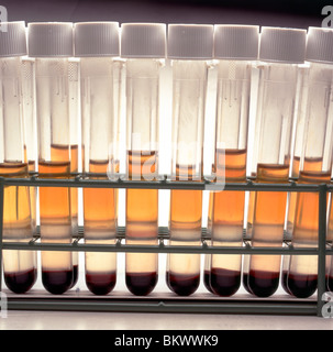 Testen Sie Röhren von menschlichen Zellen auf biomedizinische Forschungs- und Entwicklungslabor Stockfoto