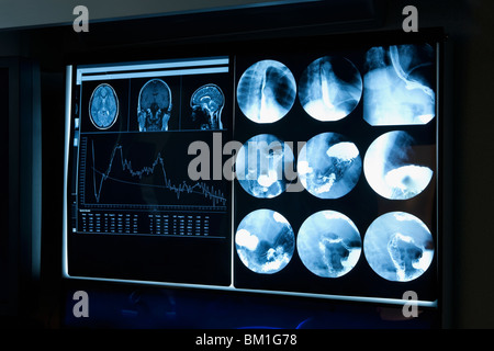 Nahaufnahme von MRI-Scan-Bericht Stockfoto
