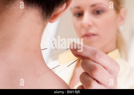 Akupunktur Nadeln auf eine Person anwenden Stockfoto