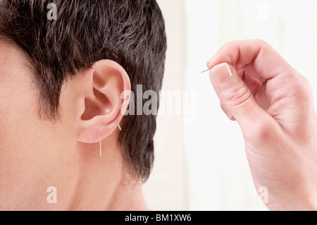 Akupunkteur, die Anwendung von Nadeln am Ohr eines Mannes Stockfoto