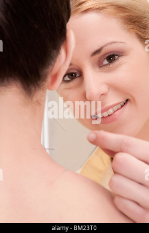 Akupunktur Nadeln auf einer Frau Rücken anwenden Stockfoto