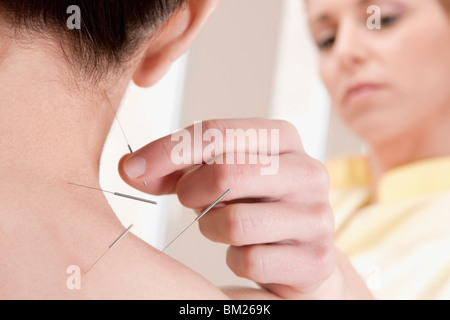 Akupunktur Nadeln auf eine Person anwenden Stockfoto