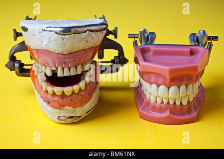 Dental-Modelle, schlechte Zähne, gute Zähne Stockfoto