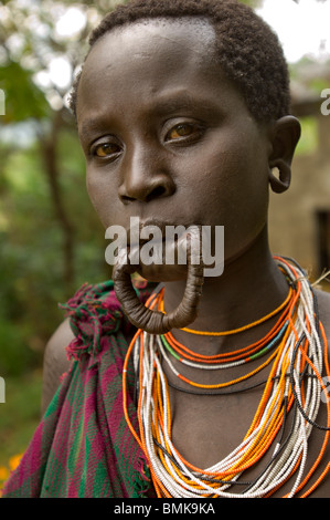 Äthiopien, Omo Region, Tulgit. Suri (Surma) Frau mit losen Lippe wo ihr Mundlochplatte wäre. Stockfoto