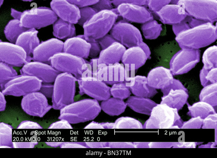 SEM der Anthrax-Bakterien-Sporen (Bacillus Anthracis) Stockfoto