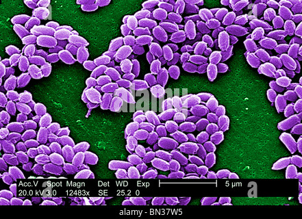 SEM der Anthrax-Bakterien-Sporen (Bacillus Anthracis) Stockfoto