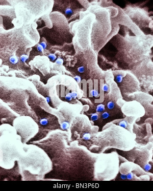 Eingefärbte scanning Electron Schliffbild des menschlichen Immunodeficiencyvirus (HIV), angebaut in kultivierten Lymphozyten Stockfoto