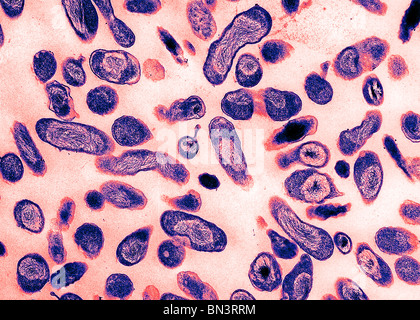 Elektronenmikroskopische Aufnahme von Coxiella Burnetti, die Bakterien, q-Fieber Stockfoto